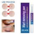 Eelhoe Doctor Proven Verruca & Wart Removing Pen. 