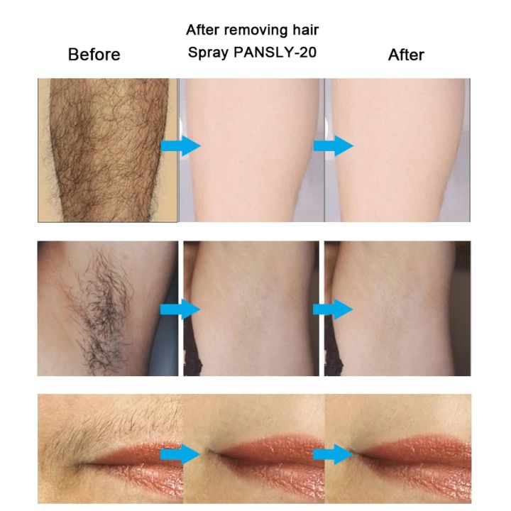 PANSLY%20Hair%20Growth%20Inhibitor%20Facial%20Removal%20Cream%20Spray%20Beard%20Bikini%20Intimate%20Face%20Legs%20Body%20Armpit%20Painless%2050Ml%20-%20Image%203