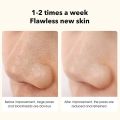 Pinjing Blackhead Remover Pore Vacuum with 0.3MP Macro Camera/HD APP Display/2 Suction Probes/3 Modes Electric Blackhead Vacuum Extractor Clean Tool Microdermabrasion Pimple Extractor Facial Skin Care Beauty Tool-green.
