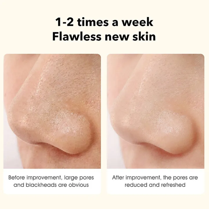 Pinjing%20Blackhead%20Remover%20Pore%20Vacuum%20with%200.3MP%20Macro%20Camera/HD%20APP%20Display/2%20Suction%20Probes/3%20Modes%20Electric%20Blackhead%20Vacuum%20Extractor%20Clean%20Tool%20Microdermabrasion%20Pimple%20Extractor%20Facial%20Skin%20Care%20Beauty%20Tool-green%20-%20Image%205