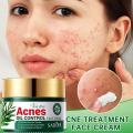 SADOER Facial Cream Acne Care Moisturizing Tea Tree Oil Acne Pimple Scar Removal Anti Acne for Face Skin Care - 50g. 
