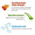 Wow Skin Science Apple Cider Vinegar Facewash 100ml. 