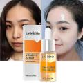 LANBENA Vitamin C Serum VC Removing Dark Spots Freckle Speckle Fade Skin Care Whitening Face Anti Winkles Essence Beauty-15ml. 
