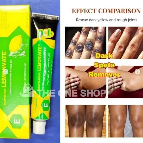 Lemonvate%20Cream%20-%2030gm%20(Italy)%20-%20Image%203