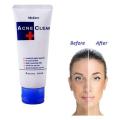 Mistine Acne Clear Facial Foam Face Wash - 85Gm (Made In Thailand) - Face Wash. 