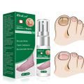 New Nail Repair Eence Fungal Removal Gel Anti Infection Paronychia Onychomycoi 10ml. 