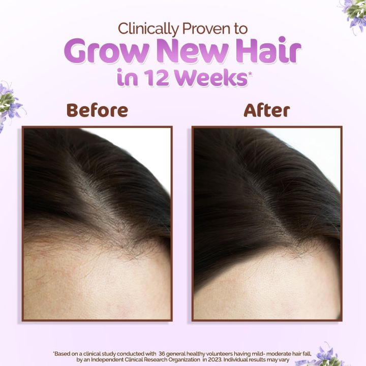 Mamaearth%20Rosemary%20Hair%20Oil%20%E2%80%93%20With%20Rosemary%20&%20Methi%20Dana%20%7C%20Strengthens%20Roots,%20Reduces%20Hair%20Fall%20&%20Boosts%20Hair%20Growth%20%E2%80%93%20150ml%20-%20Image%203