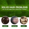 EELHOE 100ml Tinea Dispelling Anti-itching Shampoo Anti-dandruff Shampoo Hair Shampoo Treatment Oil Refreshing Control. 