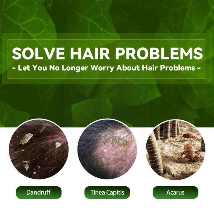 EELHOE%20100ml%20Tinea%20Dispelling%20Anti-itching%20Shampoo%20Anti-dandruff%20Shampoo%20Hair%20Shampoo%20Treatment%20Oil%20Refreshing%20Control%20-%20Image%204