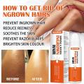 Ingrown hair after shaving treatment for dark spots repair serum M2Z1.