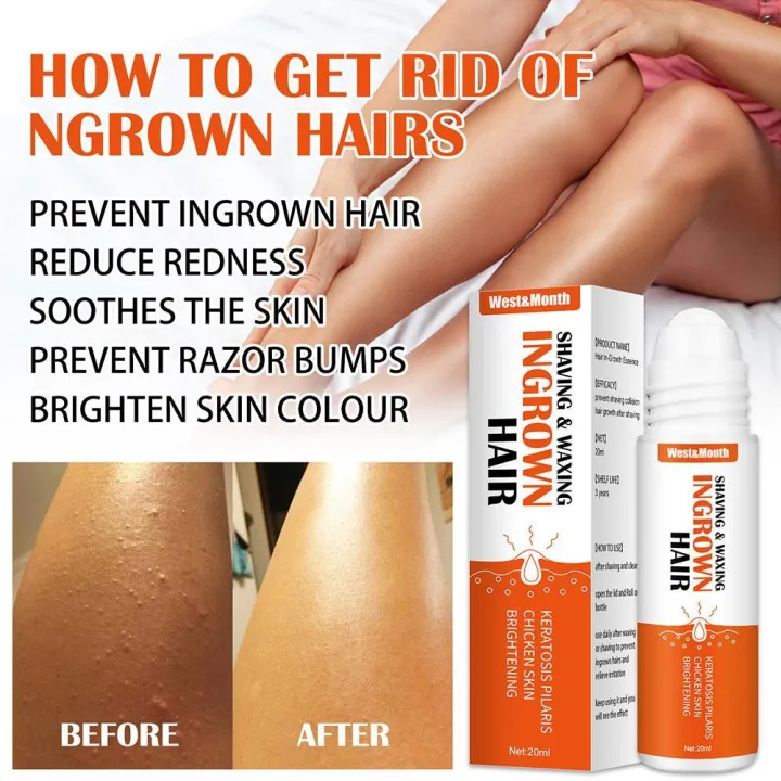 Ingrown%20hair%20after%20shaving%20treatment%20for%20dark%20spots%20repair%20serum%20M2Z1%20-%20Image%206