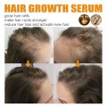 30ml Biotin Fast Hair Growth Products Anti Hair Loss Serum Spray Prevent Baldness Treatment Scalp Beard Beauty Hair Care For Men Women.