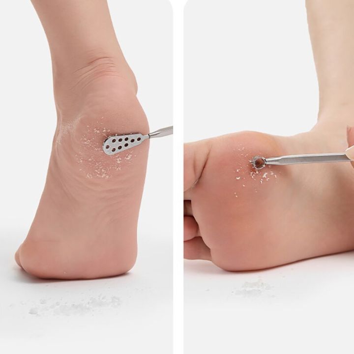 1Pc%20Toe%20nail%20Scraper%20Manicure%20Tools%20Feet%20Nail%20Ingrown%20Cuticle%20Pedicure%20Knife%20Set%20Dead%20Skin%20Remover%20Files%20Foot%20Care%20Pedicure%20Tool%20-%20Image%208