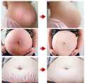 Scar Removal Cream Repairing Damaged Skin Reducing Scars And Smoothing The Skin 50g, কাটা ও পুড়ে যাওয়ার দাগ স্কিন থেকে মুছে ফেলুন। মুখমন্ডল, হাত, পা, বডি অথবা স্কিনের যেকোনো যায়গাতে ব্যবহার করতে পারবেন, #lazbinstore. 