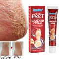 Feet Care Mask Foot Cream Hand Cracked Repair Cream Removal Dead Skin Hand Feet Care SkinTreatment Exfoliation. 