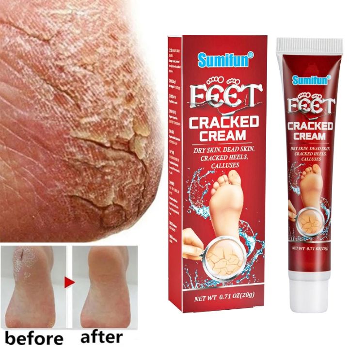 Feet Care Mask Foot Cream Hand Cracked Repair Cream Removal Dead Skin Hand Feet Care SkinTreatment Exfoliation