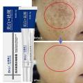 Effective Whitening Freckles Cream Remove Melasma Dark Spots Fade Pigmentation Moisturize Brighten Face Korean Skin Care Product. 