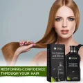 Dexe Anti Hair Loss Shampoo 200ml (Men & Women). 