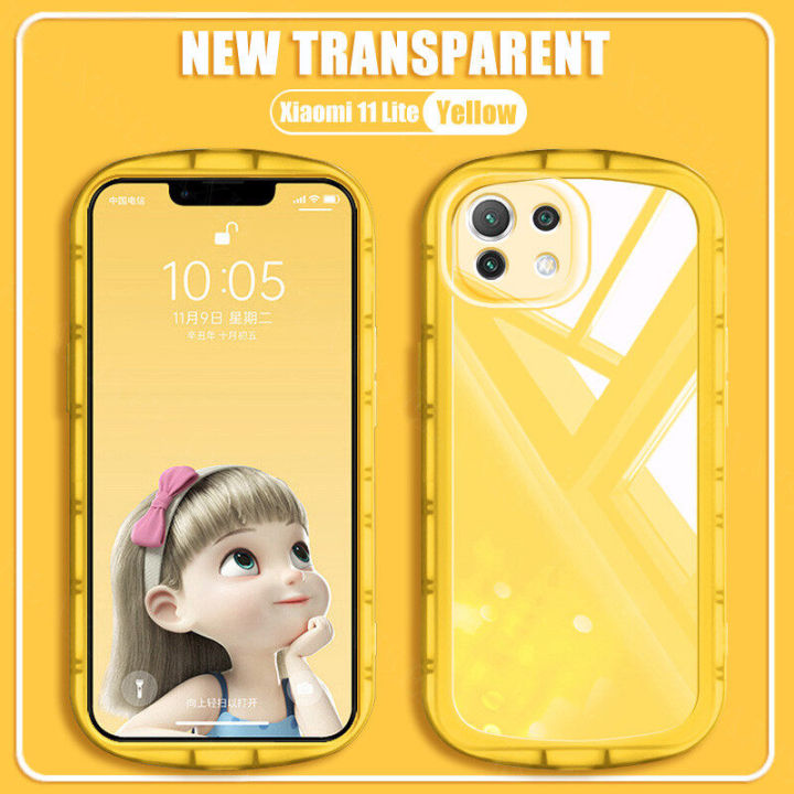 AnDyN%20phone%20case%20for%20Xiaomi%20Mi%2011%20Lite%205G%20NE%20Phone%20Case%20New%20Transparent%20Big%20Eyes%20Ultra-Thin%20Lens%20All-Inclusive%20Silicone%20Soft%20Case%20-%20Image%208