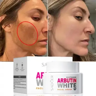 SADOER%20Nicotinamide%20Arbutin%20White%20Facial%20Cream%2050g%20-%20Image%202