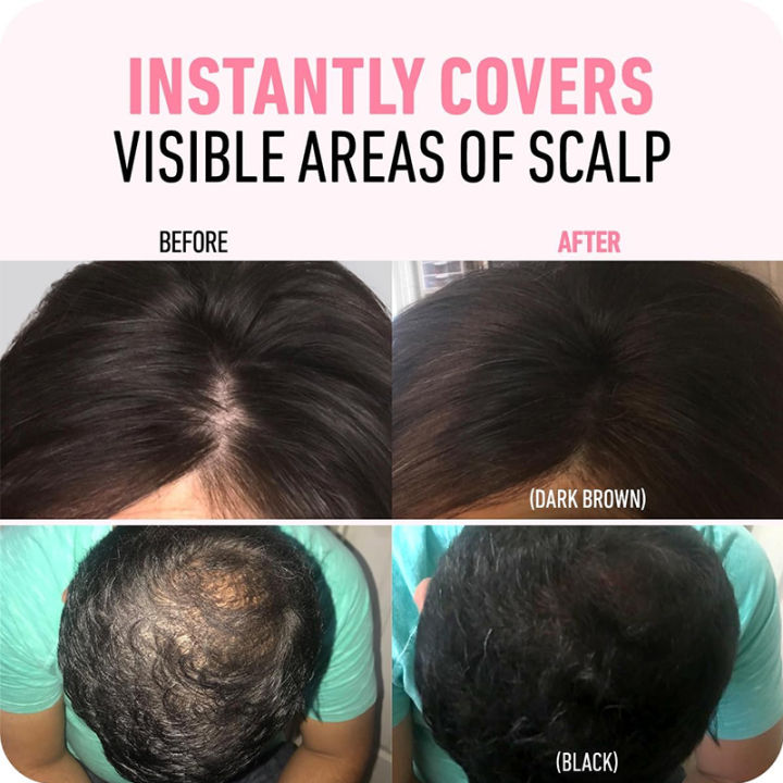 14%20Color%20Hair%20Line%20Powder%20Black%20Root%20Up%20Natural%20Instant%20Waterproof%20Hairline%20Shadow%20Concealer%20Coverage%20Paint%20Repair%20Fill%20In%20Hair%20-%20Image%206