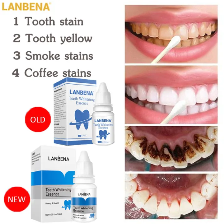 Lanbena%20Teeth%20Whitening%20Essence%20-%2010ml%20-%20Image%202