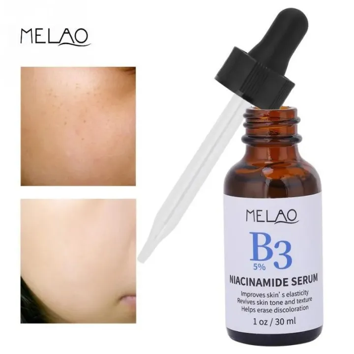 Melao%20B3%205%25%20Niacinamide%20Serum%20%E2%80%93%2030%20ml%20-%20Image%202