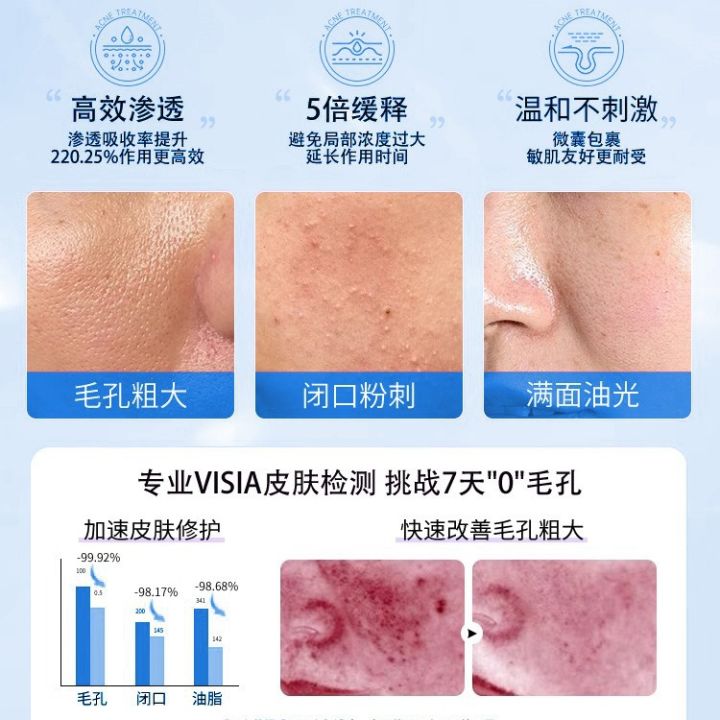 GE%20Baolian%20Salicylate%20Clean%20Pores%20Acne%20Treatment%20Cream%20Pore%20Cleanser%20Shrink%20Pores%20Essence%20Cream%20Improve%20Skin%20-%20Image%202