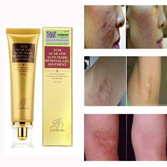 LANBENA TCM scar and Acne Spot Removal Gel Ointment