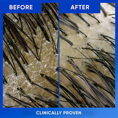 Head%20&%20Shoulders%20Clarify%20&%20Shine%20Anti-Dandruff%20Shampoo%20800ML%20(Direct%20London%20to%20Dhaka%20Hub)%20-%20Image%206