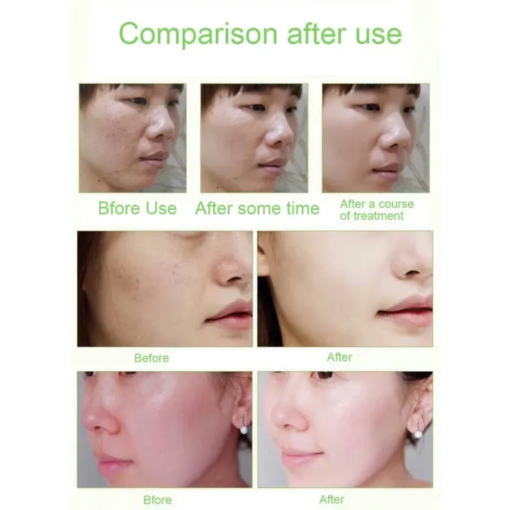 Skin%20Cafe%20Pure%20&%20Natural%20Aloe%20Vera%20gel%2092%25%20-%20Image%208