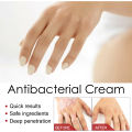 Psoriasis Treatment Cream Antibacterial Dermatitis Eczema Therapy Relieve Rash Urticaria Skin Herbal Skin Anti Itch Ointment 30g.