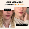 120ml 99% Vitamin C Serum Oil Facial Serum AHA Kojic Acid glutathione Facial skin brightening. 
