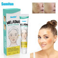 Sumifun Melasma Relief Cream 20g – Dark Spot Remover & Brightening Cream | Helps Reduce Melasma, Sun Spots, Freckles & Pigmentation | Herbal Nourishing Skin Care. 