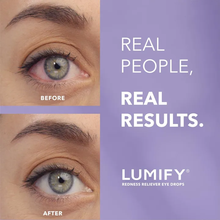 LUMIFY%20Redness%20Reliever%20Eye%20Drops,%20for%20Whiter%20&%20Brighter%20Looking%20Eyes,%200.08%20Fl%20Oz%20%202.5%20ml%20-%20Image%205