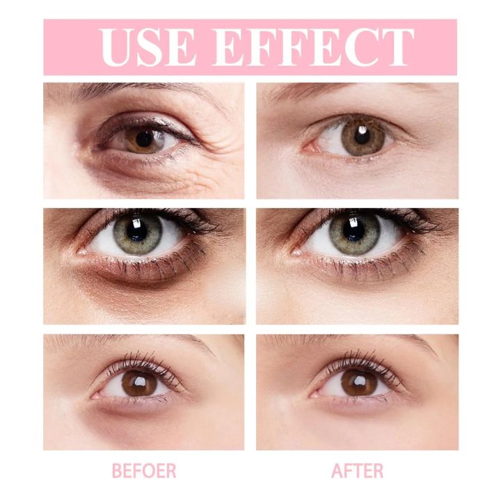 Women%20Retinol%20Eye%20Cream%20Lifting%20Moisturizing%20Balm%20Stick%20Remove%20Dark%20Circles%20Eye%20Care%20Anti-Wrinkle%20Anti-Puffiness%20Cream%20Vnce%20Lncei%20-%20Image%205
