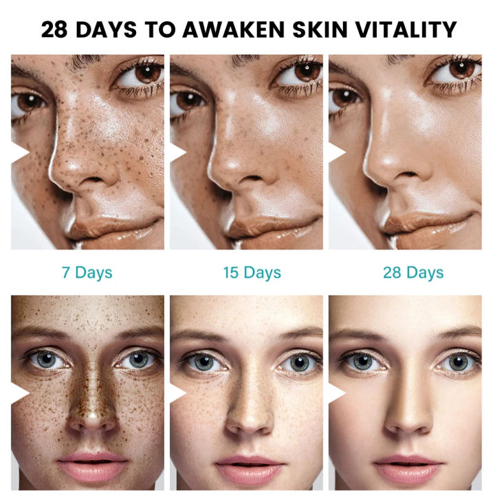 Sumifun%20Melasma%20Relief%20Cream%2020g%20%E2%80%93%20Dark%20Spot%20Remover%20&%20Brightening%20Cream%20%7C%20Helps%20Reduce%20Melasma,%20Sun%20Spots,%20Freckles%20&%20Pigmentation%20%7C%20Herbal%20Nourishing%20Skin%20Care%20-%20Image%204