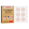 Invisible Concealer Sticker Skin Color Concealer Tattoo Stickers Cover Up Burn Scar Birthmark Invisible Patch Waterproof Tape. 