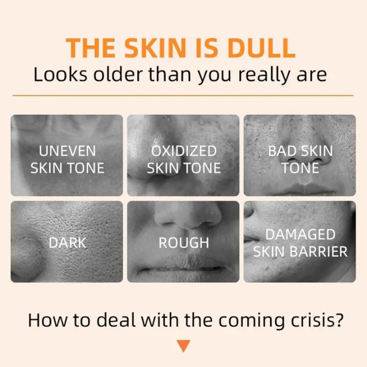 Peeling%20Gel%20For%20Face%20Orange%20Brightening%20Gel%20Dead%20Skin%20Remover%20For%20Face%20Gently%20Exfoliator%20For%20All%20Skin%20Types%20Face%20Moisturizer%20-%20Image%205