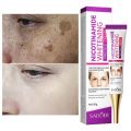 SADOER Niacinamide Whitening Freckle Cream Effectively Removes Melasma Lightens Black Spots Acne Marks Brightens Skin Care-20gm. 