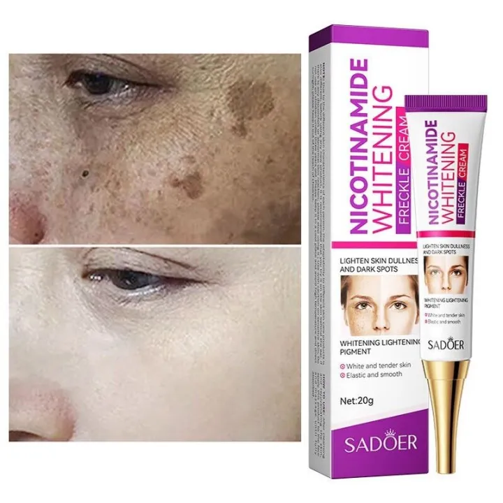 SADOER%20Niacinamide%20Whitening%20Freckle%20Cream%20Effectively%20Removes%20Melasma%20Lightens%20Black%20Spots%20Acne%20Marks%20Brightens%20Skin%20Care-20gm%20-%20Image%202