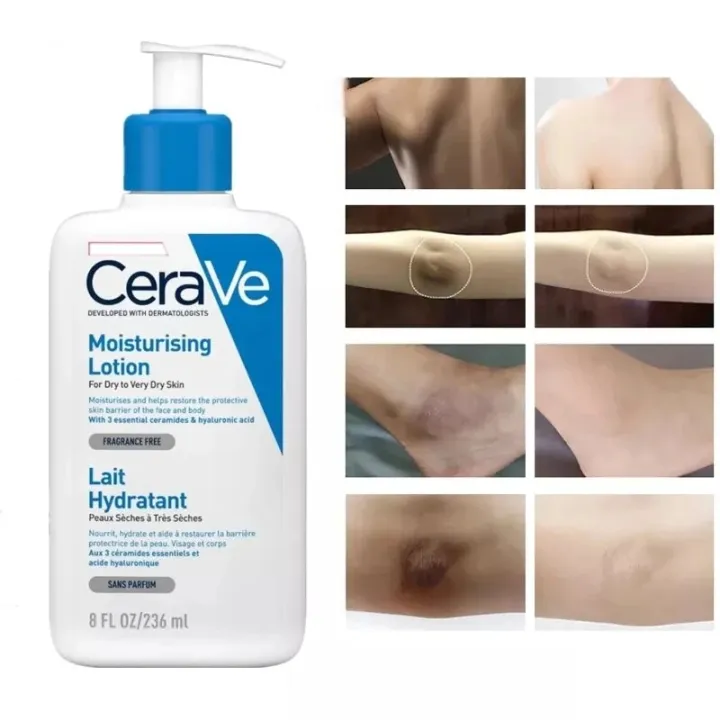 CeraVe%20Skincare%20Products%20C%20Serum%20Acne%20Control%20Hydrating%20Foaming%20SA%20Cleanser%20Smoothing%20AM%20PM%20Lotion%20All%20Skin%20Types%20Moisturising%20-%20Image%207
