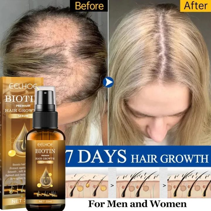 30ml Biotin Fast Hair Growth Products Anti Hair Loss Serum Spray Prevent Baldness Treatment Scalp Beard Beauty Hair Care For Men Women