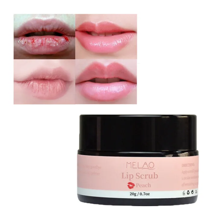 MELAO%20Lip%20Exfoliator%20Lip%20Scrub%20Nourishing%20Lipstick%20Remove%20Lip%20Cuticles%20-20%20g%20-%20Image%204