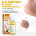 ellow Peeling Oil Extra Strength, Super Strength Yellow Peeling Oil Lightening Exfoliating, Butter Peeling for Dark Skin, Body, Face, Dark Spots, Brightening Complexion.