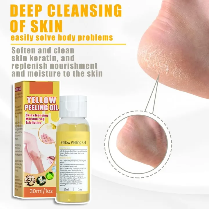 ellow%20Peeling%20Oil%20Extra%20Strength,%20Super%20Strength%20Yellow%20Peeling%20Oil%20Lightening%20Exfoliating,%20Butter%20Peeling%20for%20Dark%20Skin,%20Body,%20Face,%20Dark%20Spots,%20Brightening%20Complexion%20-%20Image%205