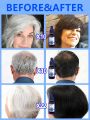 White hair killer, remove gray hair and restore natural hair color in 7 days. 