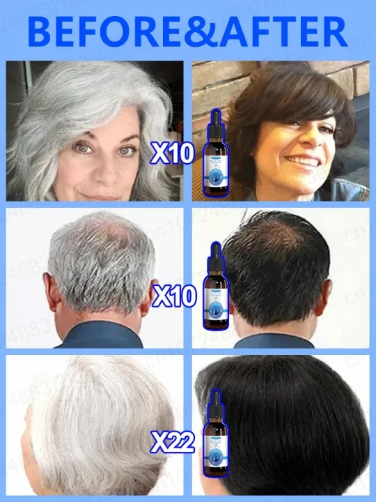 White%20hair%20killer,%20remove%20gray%20hair%20and%20restore%20natural%20hair%20color%20in%207%20days%20-%20Image%203