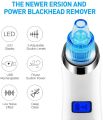 Comedo Suction Blackhead Remover. 