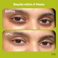Deyga Under Eye Cream (15 Gm) | Lightens Dark Circles | Reduces Puffiness & Fine lines | Chemical-free | Suits Men and Women | Reduces Dark Circles, Wrinkles, and Fine Lines(From india). 